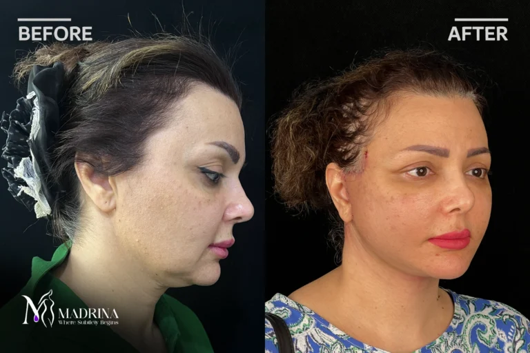 نمونه کار کلینیک مادرینا