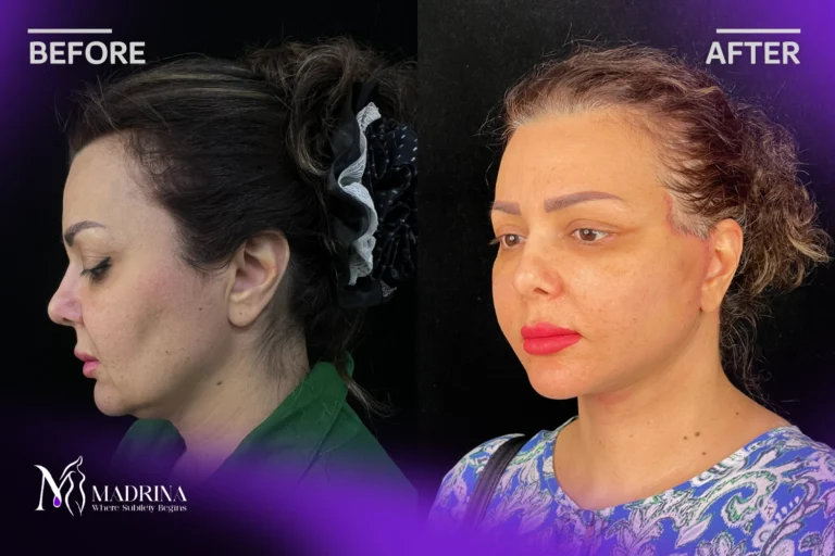 نمونه کار کلینیک مادرینا
