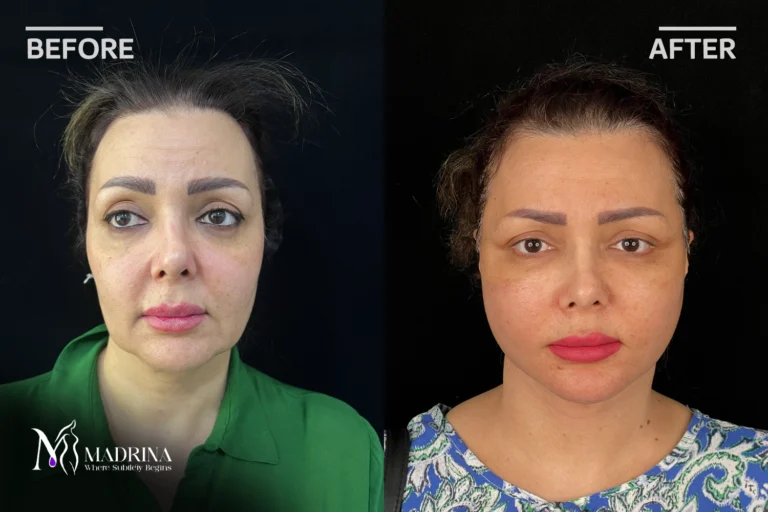 نمونه کار کلینیک مادرینا